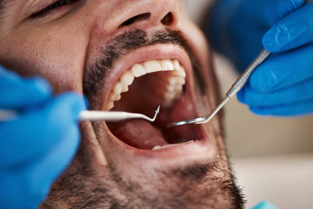 Best Emergency Care for Gum Disease in Palm Valley, FL